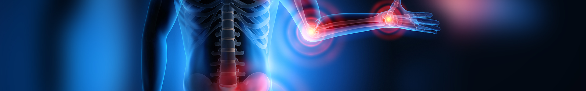 International Journal of Arthritis banner